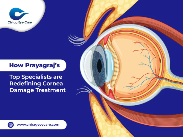 How Prayagraj’s Top Eye Specialists Are Redefining Cornea Damage Treatment