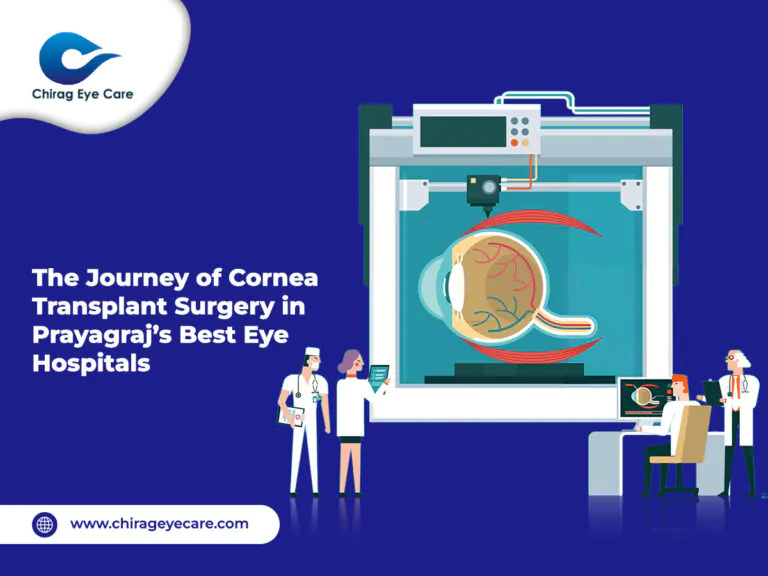 The Journey Of Cornea Transplant Surgery In Prayagraj’s Best Eye Hospitals