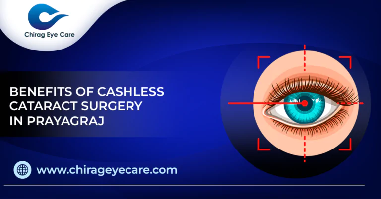 Benefits Of Cashless Cataract Surgery In Prayagraj