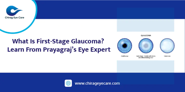 What Is First-Stage Glaucoma? Learn From Prayagraj’s Eye Expert