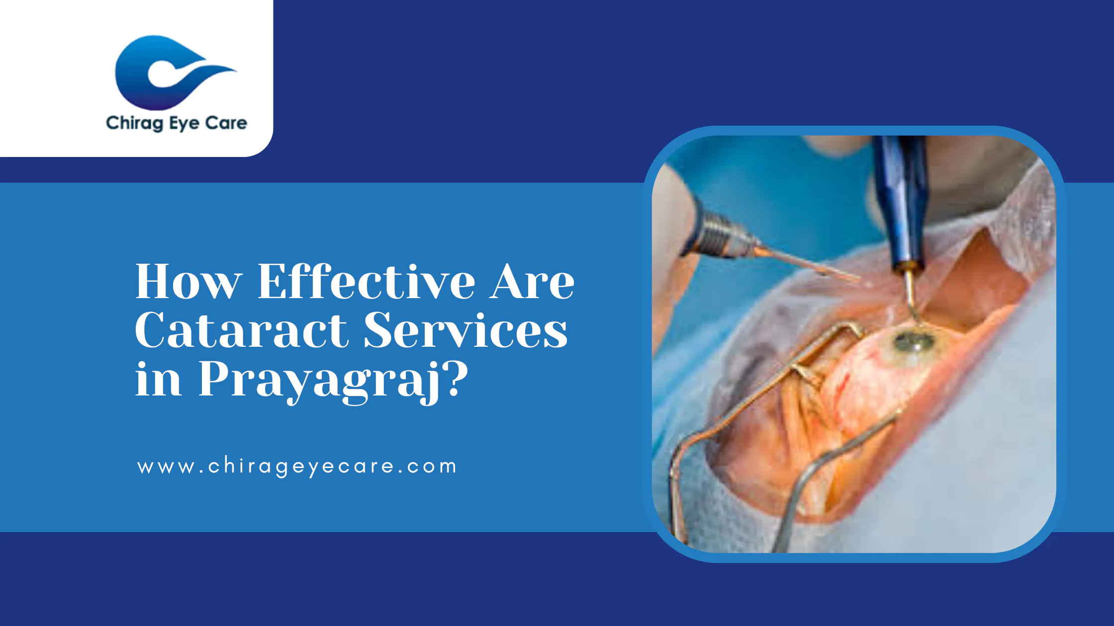 cataract services in prayagraj