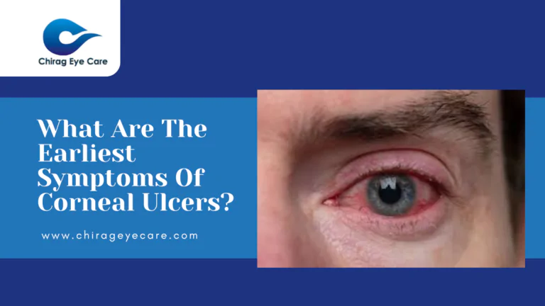 What Are The Earliest Symptoms Of Corneal Ulcers?