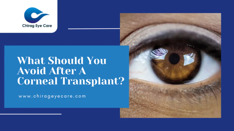 What Should You Avoid After A Corneal Transplant?